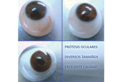prótesis oculares