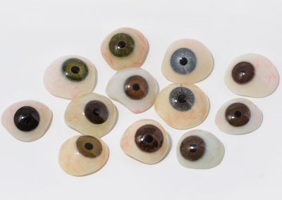 prótesis oculares